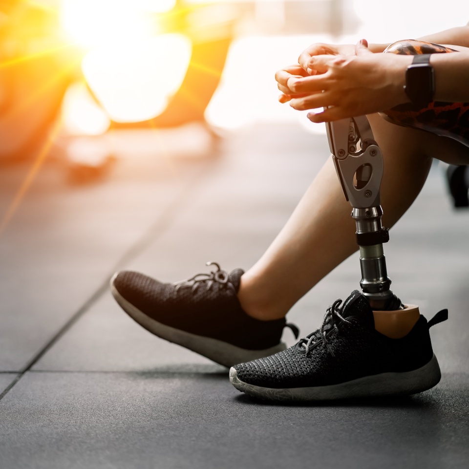 prosthetic, artificial leg. Woman with prosthetic leg using walking on treadmill while working out in gym. artificial leg. Woman wearing prosthetic equipment sit down after exercising in gym.